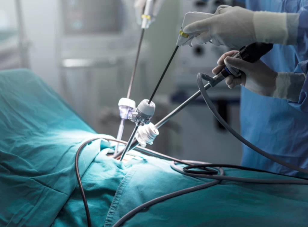 Pelvi acetabular surgery